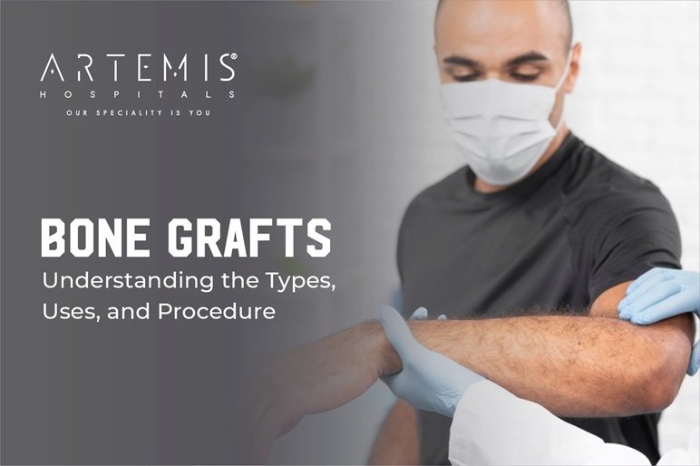 Bone Graft Types